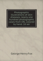 Photographic illustrations of skin diseases, nearly one hundred photographic cases from life, colored by hand. 2d ser