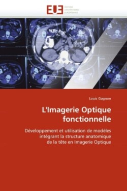 L'imagerie optique fonctionnelle