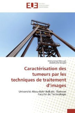 Caractérisation des tumeurs par les techniques de traitement d images