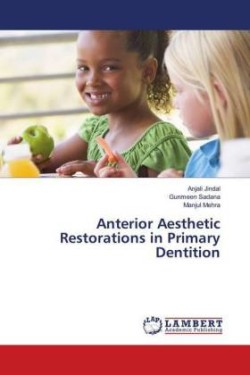 Anterior Aesthetic Restorations in Primary Dentition