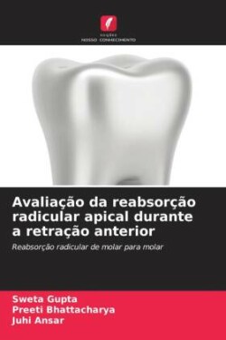 Avaliação da reabsorção radicular apical durante a retração anterior