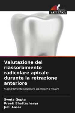 Valutazione del riassorbimento radicolare apicale durante la retrazione anteriore