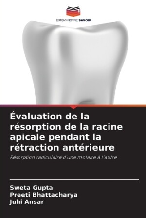 Évaluation de la résorption de la racine apicale pendant la rétraction antérieure