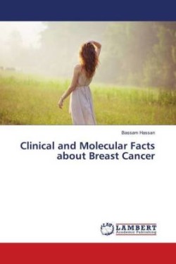 Clinical and Molecular Facts about Breast Cancer