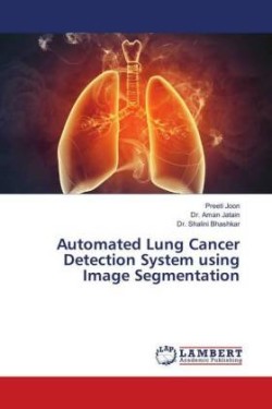 Automated Lung Cancer Detection System using Image Segmentation