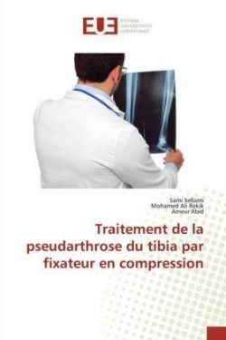 Traitement de la pseudarthrose du tibia par fixateur en compression