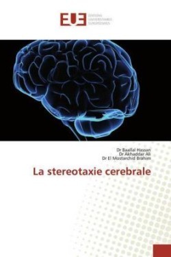 stereotaxie cerebrale