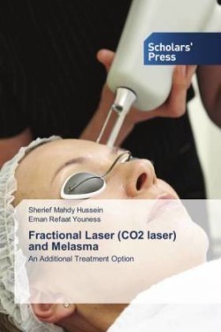 Fractional Laser (CO2 laser) and Melasma