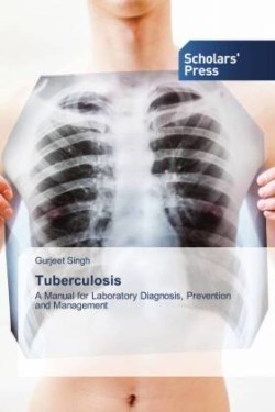 Tuberculosis