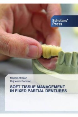 Soft Tissue Management in Fixed Partial Dentures