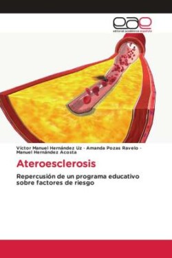 Ateroesclerosis