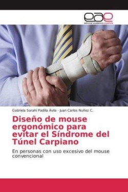 Diseño de mouse ergonómico para evitar el Síndrome del Túnel Carpiano