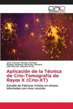 Aplicación de la Técnica de Crio-Tomografía de Rayos X (Crio-XT)