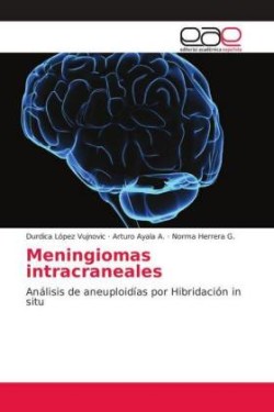 Meningiomas intracraneales