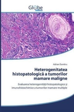Heterogenitatea histopatologica a tumorilor mamare maligne