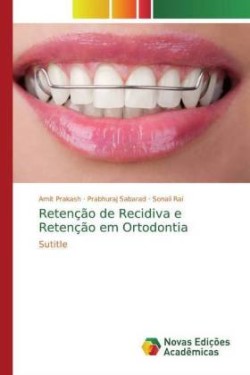 Retenção de Recidiva e Retenção em Ortodontia