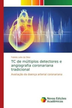 TC de múltiplos detectores e angiografia coronariana tradicional