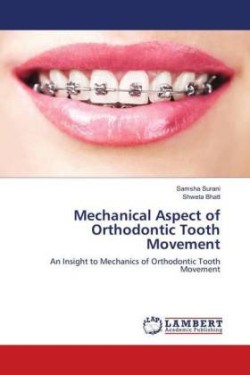 Mechanical Aspect of Orthodontic Tooth Movement