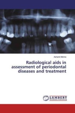 Radiological aids in assessment of periodontal diseases and treatment