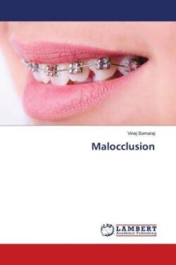 Malocclusion