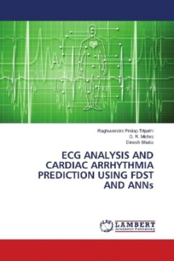 ECG Analysis and Cardiac Arrhythmia Prediction Using FDST and ANNs