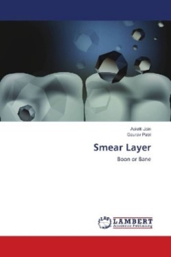 Smear Layer