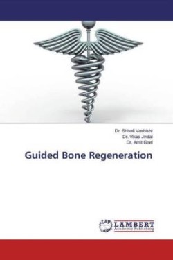 Guided Bone Regeneration