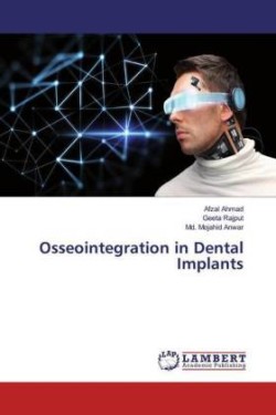 Osseointegration in Dental Implants