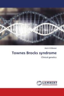 Townes Brocks syndrome