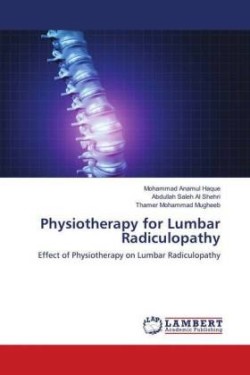 Physiotherapy for Lumbar Radiculopathy