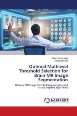 Optimal Multilevel Threshold Selection for Brain MR Image Segmentation