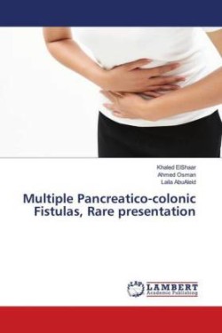 Multiple Pancreatico-colonic Fistulas, Rare presentation