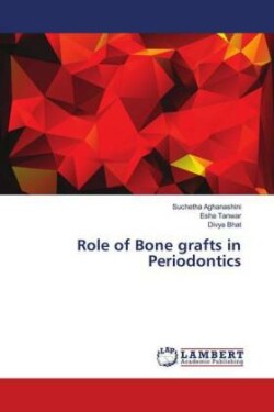 Role of Bone grafts in Periodontics