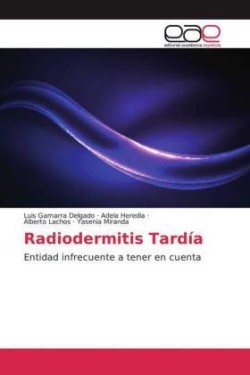 Radiodermitis Tardía