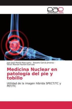 Medicina Nuclear en patología del pie y tobillo