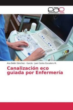 Canalización eco guiada por Enfermería
