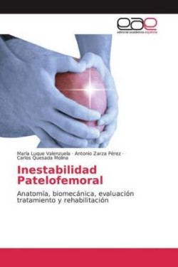 Inestabilidad Patelofemoral