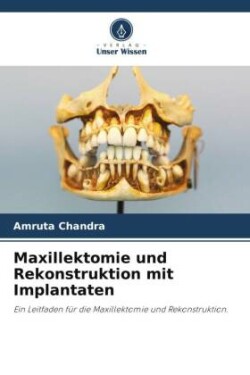 Maxillektomie und Rekonstruktion mit Implantaten