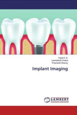 Implant Imaging