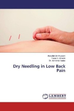 Dry Needling in Low Back Pain