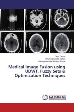 Medical Image Fusion using UDWT, Fuzzy Sets & Optimization Techniques