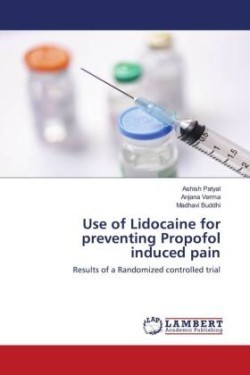 Use of Lidocaine for preventing Propofol induced pain