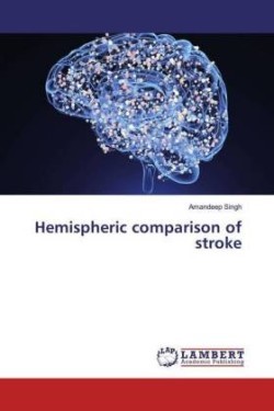 Hemispheric comparison of stroke