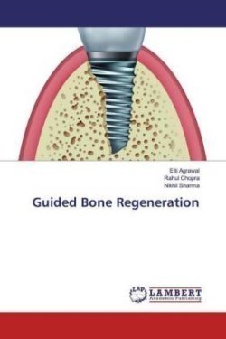 Guided Bone Regeneration