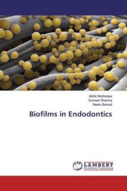 Biofilms in Endodontics