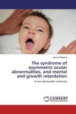 The syndrome of asymmetric ocular abnormalities, and mental and growth retardation