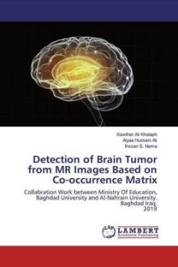 Detection of Brain Tumor from MR Images Based on Co-occurrence Matrix