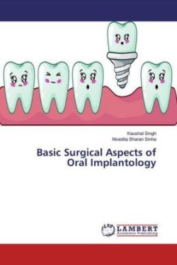 Basic Surgical Aspects of Oral Implantology