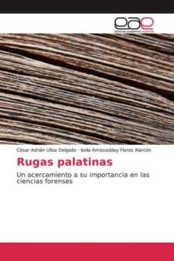 Rugas palatinas