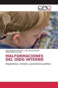 Malformaciones del Oído Interno